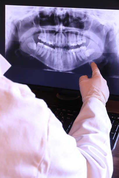 Best Walk-In Emergency Dental Services in Huntgburg, IN