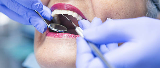 Best Emergency Root Canal Therapy in Huntgburg, IN